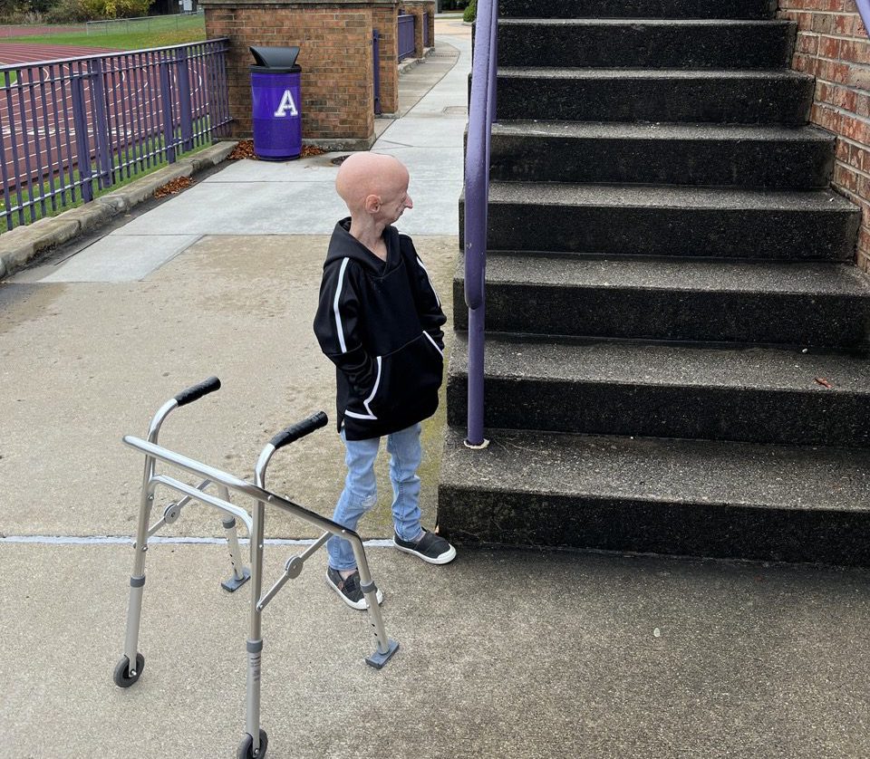 Opinion Albion College Has a Long Way Before it Can Truly Claim